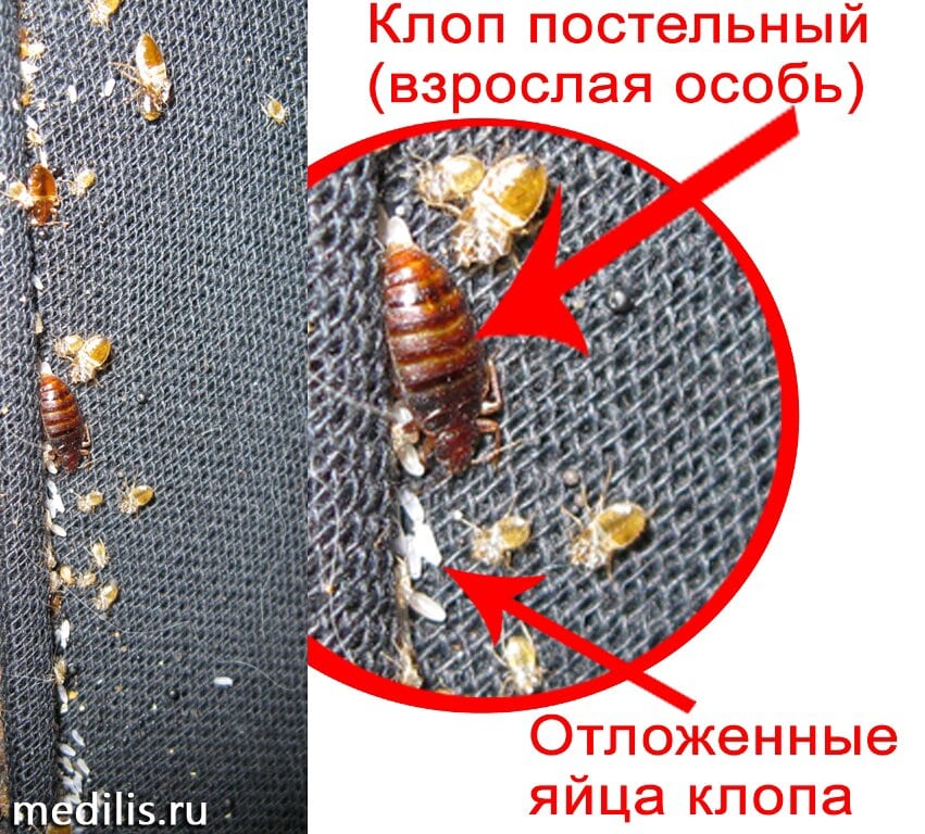 Bedbugs1.jpg (1001 KB)
