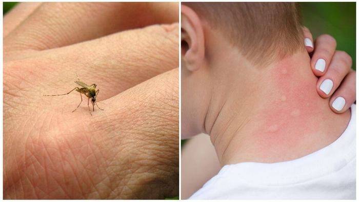 Почему нужна защита от комаров